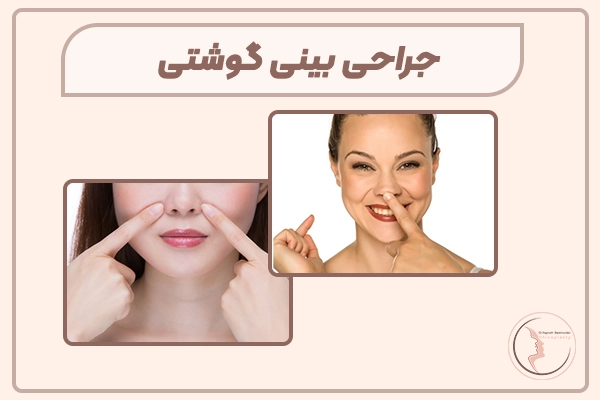عمل جراحی بینی گوشتی