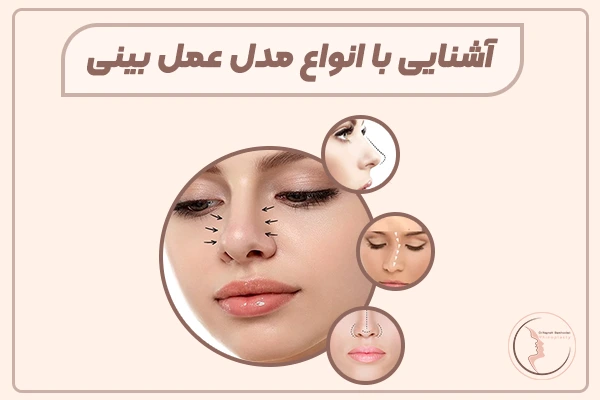 آشنایی با انواع مدل عمل بینی