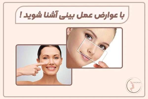 با عوارض عمل بینی آشنا شوید