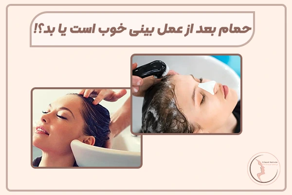 حمام بعد از عمل بینی