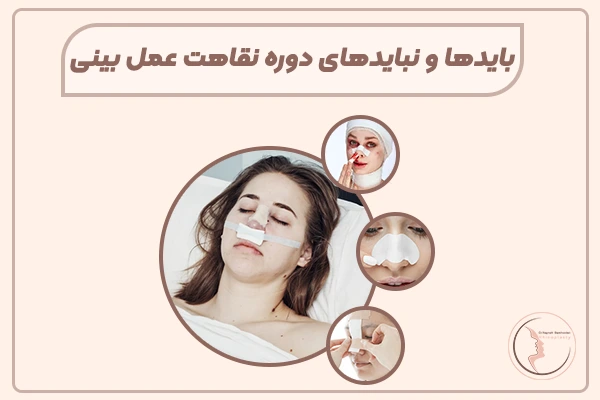 نقاهت بعد از جراحی بینی