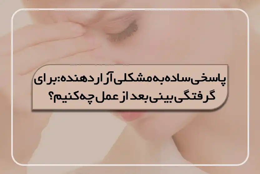 برای گرفتگی بینی بعد از عمل چه کنیم؟