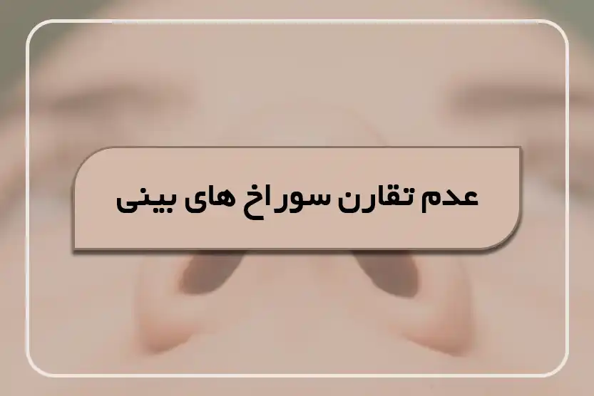 عدم تقارن سوراخ بینی