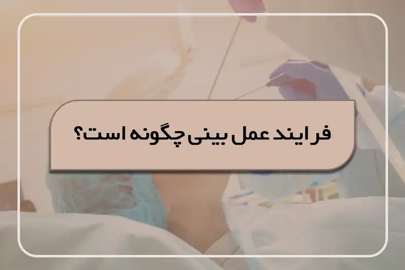 فرایند عمل بینی چگونه است؟