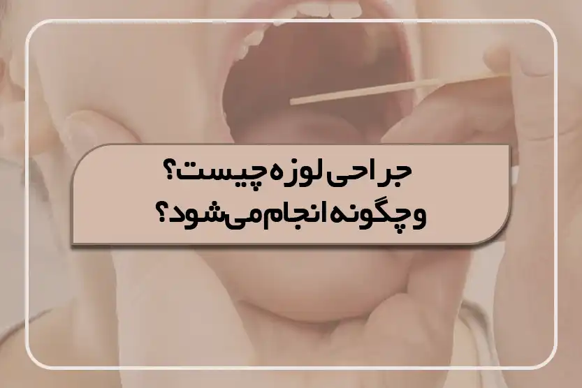 جراحی لوزه چیست؟ و چگونه انجام می_شود؟