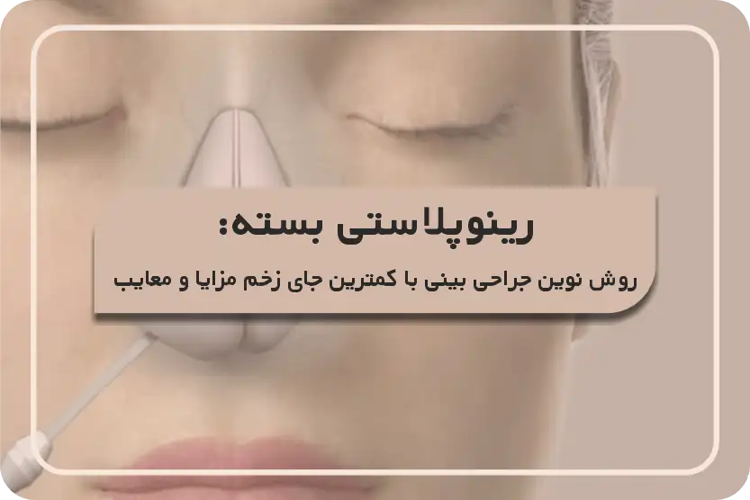 رینوپلاستی بسته چیست