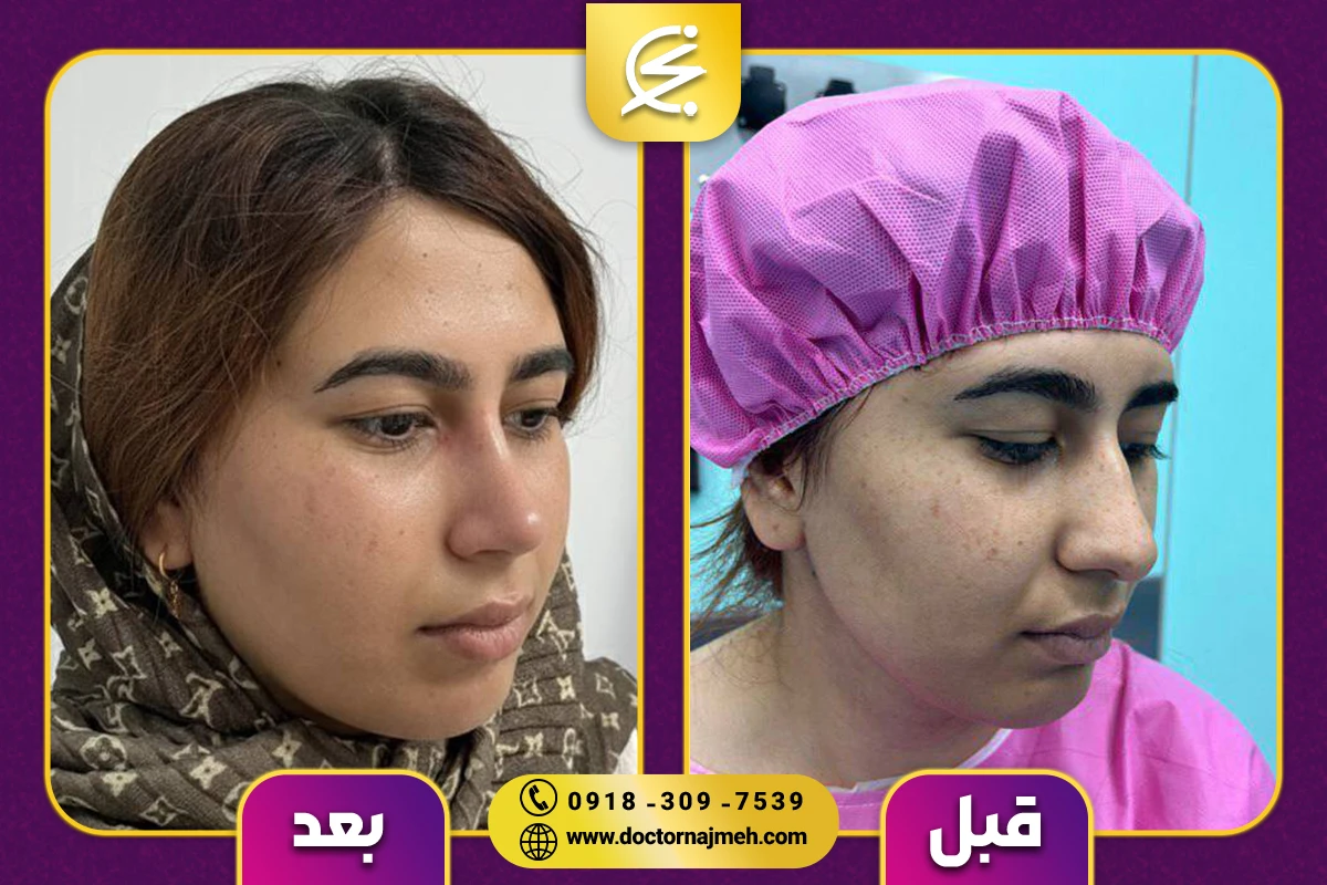 نمونه کار دکتر نجمه برخورداری کرمانشاه