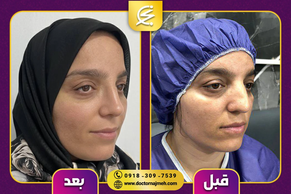 نمونه کار دکتر نجمه برخورداری کرمانشاه