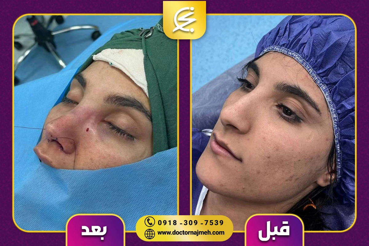 نمونه کار دکتر نجمه برخورداری کرمانشاه