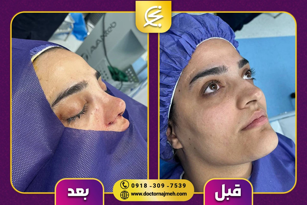 نمونه کار دکتر نجمه برخورداری کرمانشاه