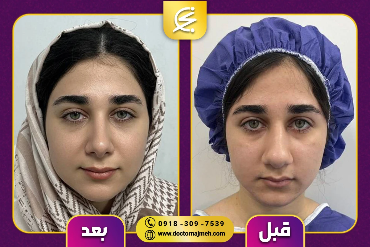 نمونه کار دکتر نجمه برخورداری یزدی