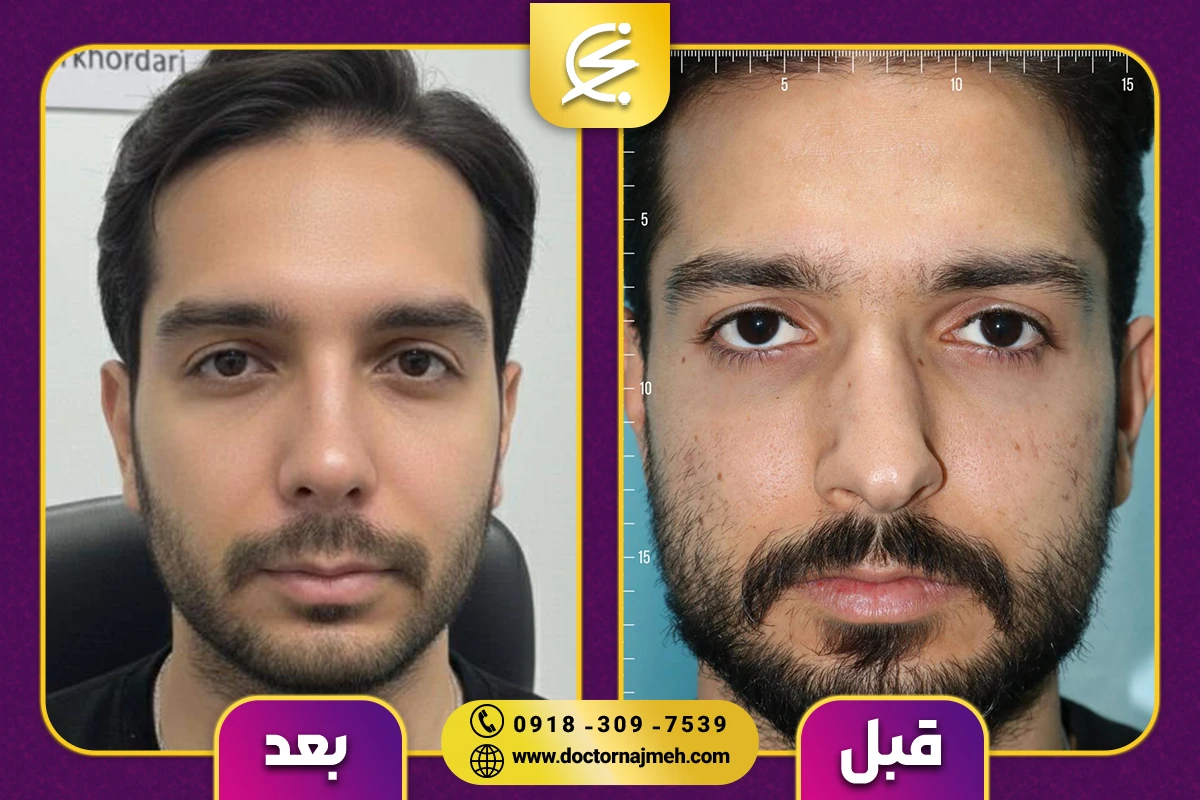 نمونه کار دکتر نجمه برخورداری یزدی