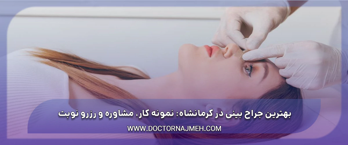 بهترین جراح بینی کرمانشاه: نمونه کار، هزینه + عمل بینی قسطی در کرمانشاه