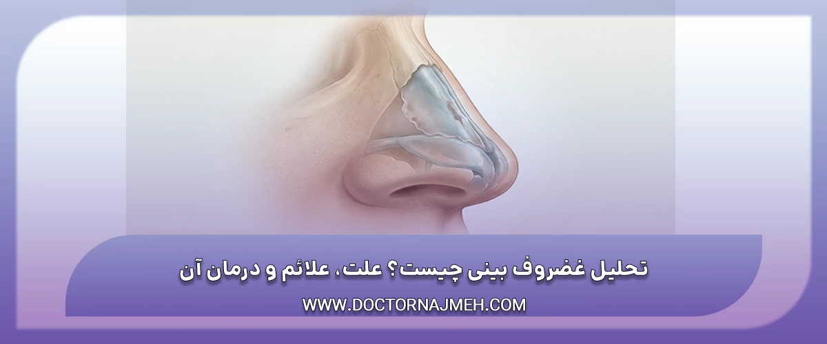 تحلیل غضروف بینی و ضعیف شدن ساختار غضروف