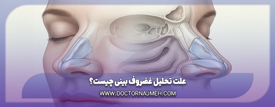 علت تحلیل غضروف بینی بعد از ضربه یا جراحی