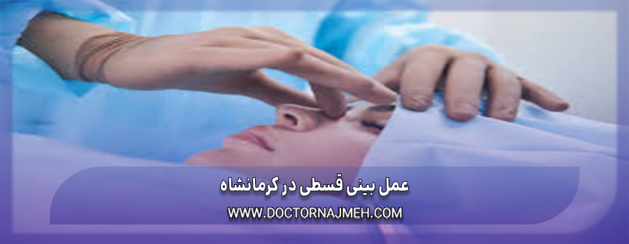 عمل بینی قسطی در کرمانشاه