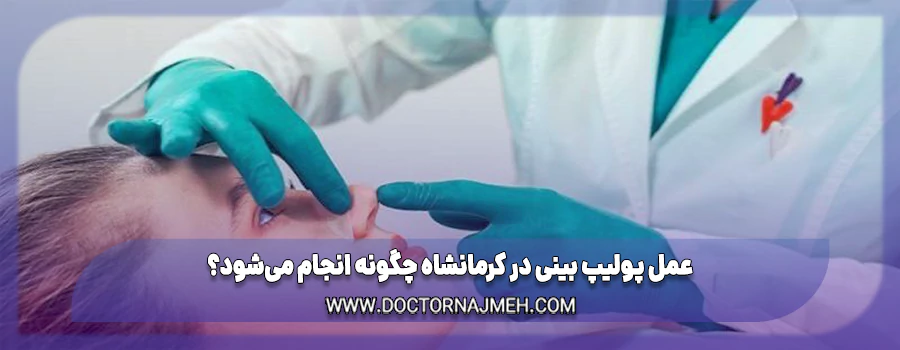 عمل پولیپ بینی در کرمانشاه چگونه انجام می‌شود؟