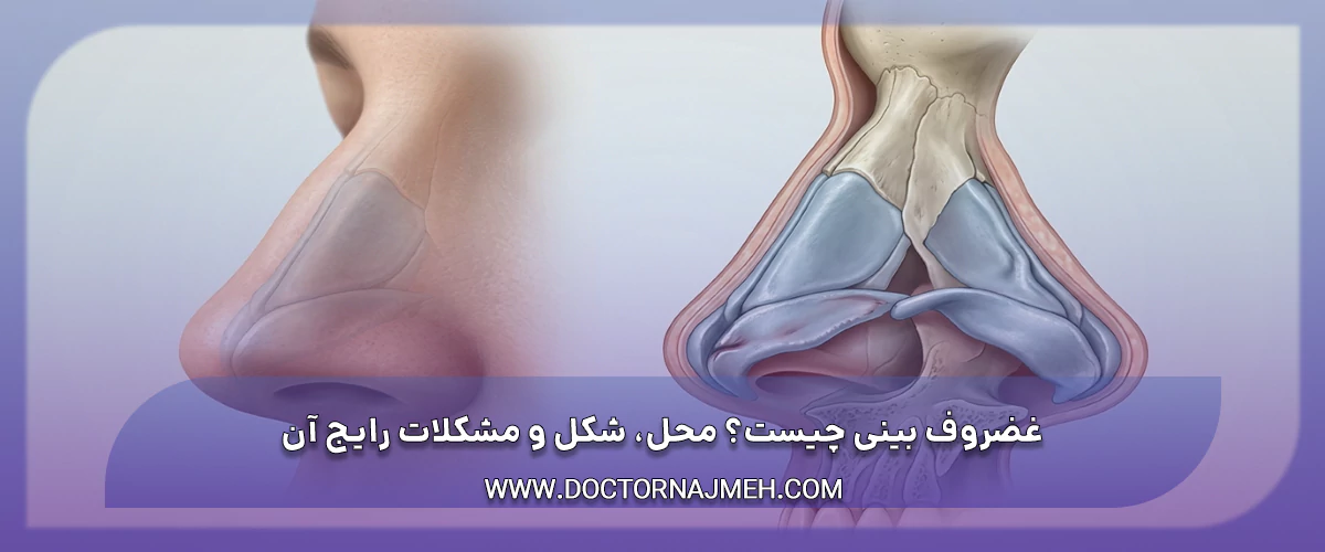 غضروف بینی چیست؟ محل، شکل و مشکلات رایج آن