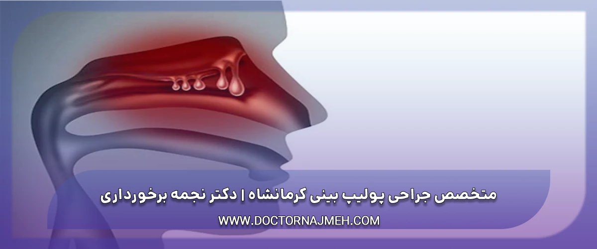 متخصص جراحی پولیپ بینی کرمانشاه دکتر نجمه برخورداری