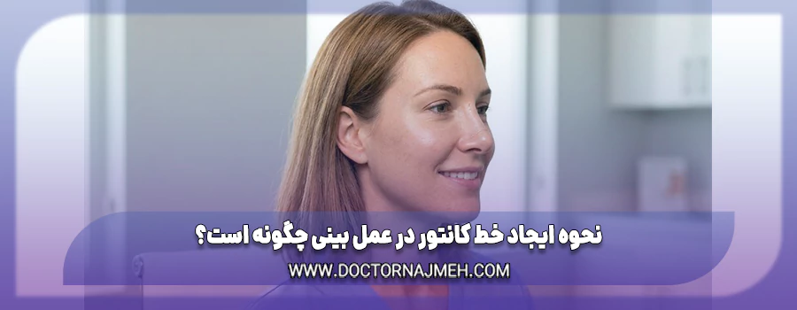 نحوه ایجاد خط کانتور در عمل بینی چگونه است؟