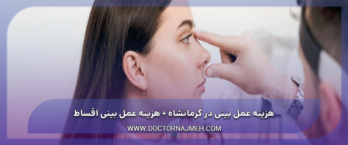 هزینه عمل بینی کرمانشاه