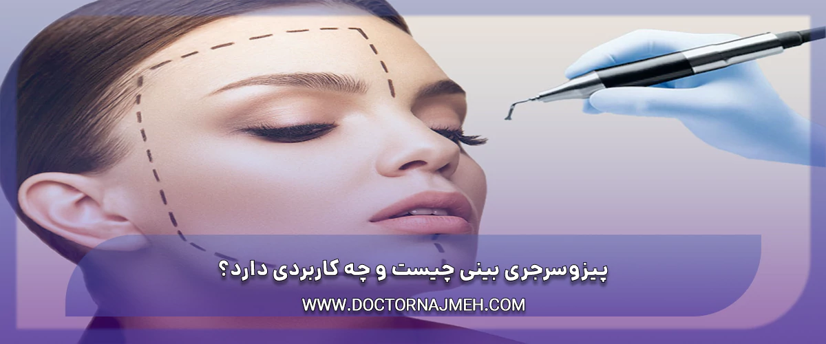 پیزوسرجری بینی چیست و چه کاربردی دارد؟